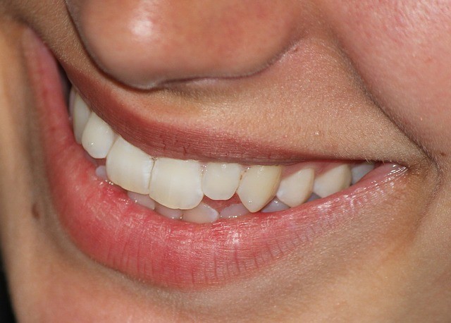 smile 665433 640